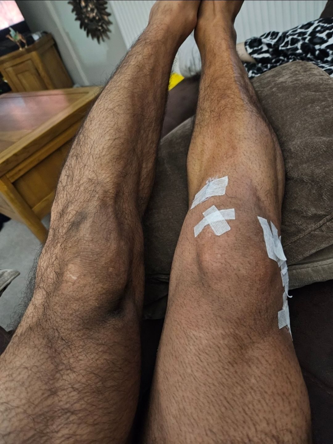 Please fhck off swelling.